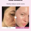 the-niacinamide-15-serum-cosrx-official-8